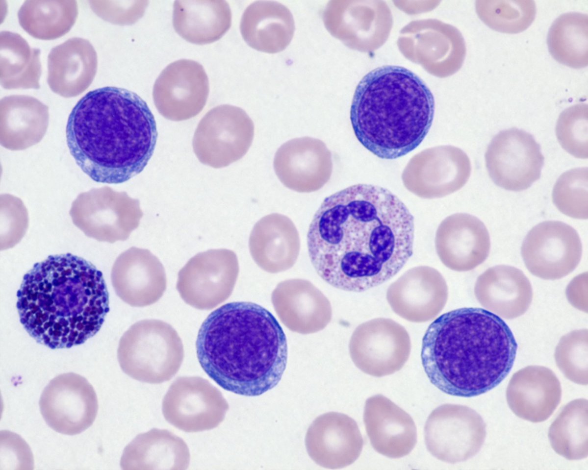 Biological Specimen Microscopy Prompt Qwen Image 프롬프트 예시: A scientific prompt for generating realistic microscopic images of blood smears with Giemsa staining.